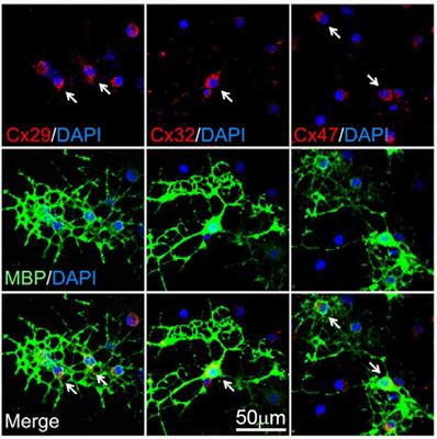 Connexin and Pannexin-Based Channels in Oligodendrocytes: Implications in Brain Health and Disease